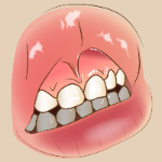 上唇をめくった状態で歯茎と白い歯が見えているイラスト