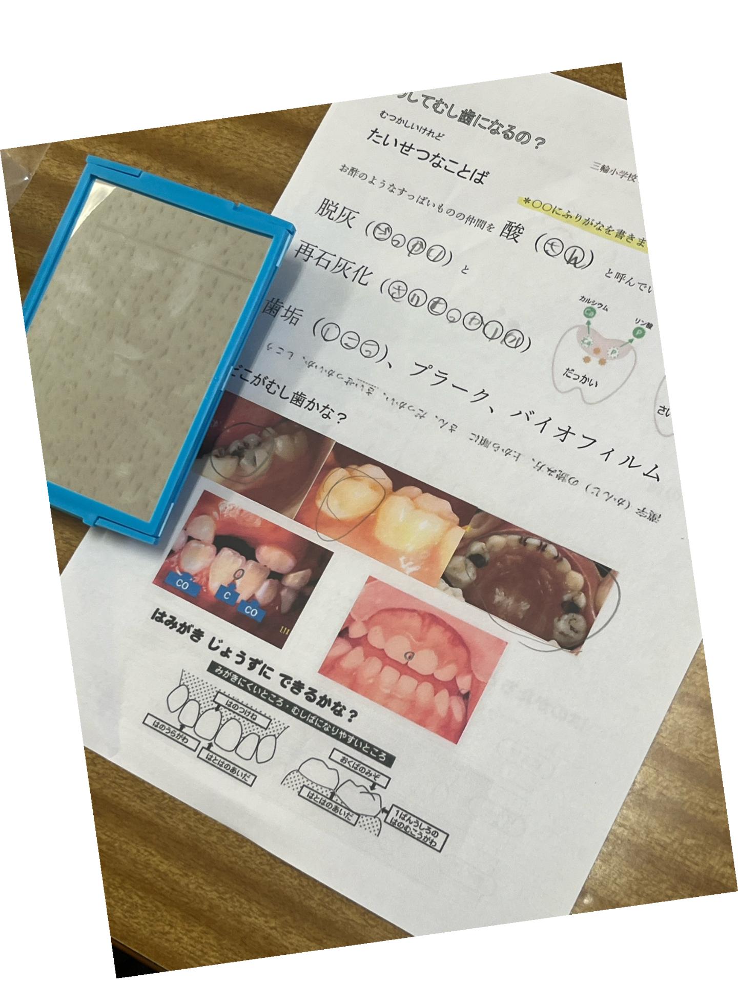 歯磨き指導プリント